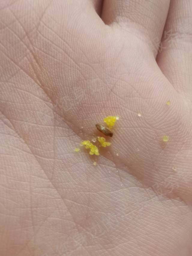 喜多多产品质量缺陷