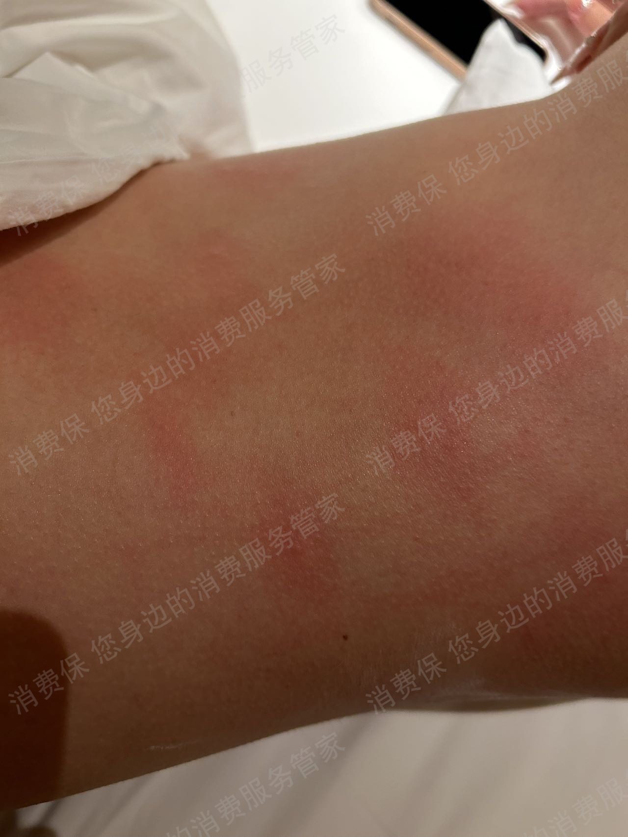 凯悦酒店安全问题