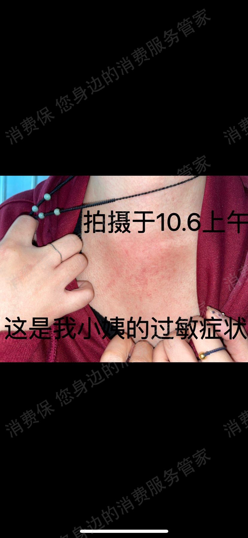 俏佳银退款纠纷