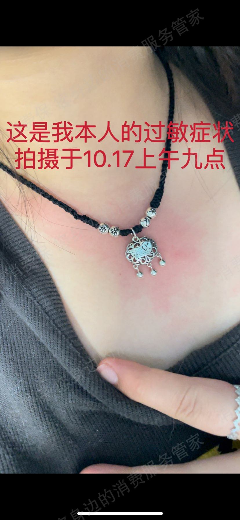 俏佳银商品质量问题