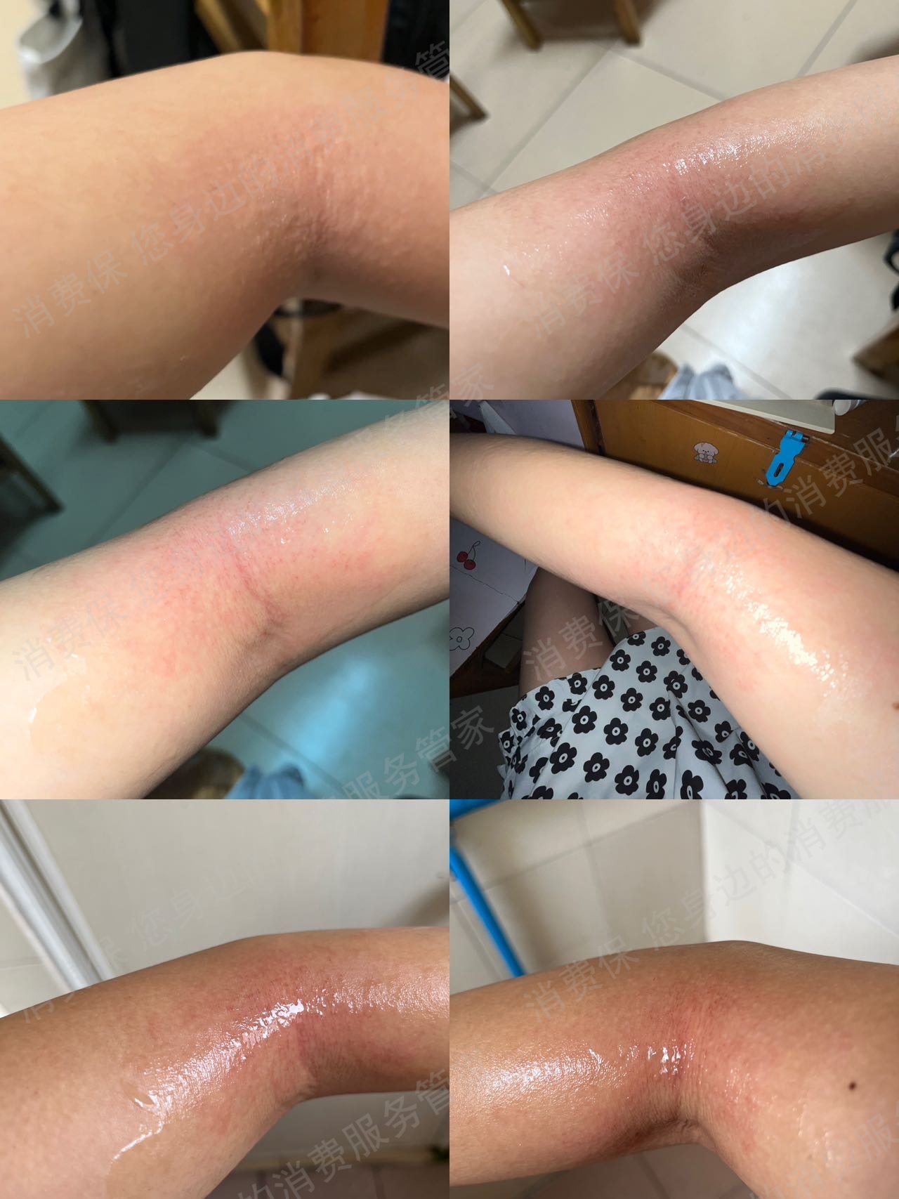 拼多多watercome水之蔻官方旗舰店产品质量缺陷
