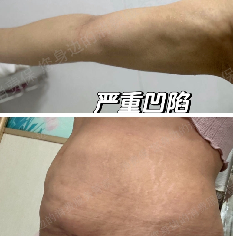 医美