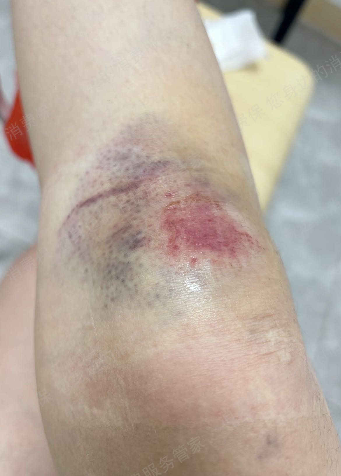 淘宝网产品质量缺陷