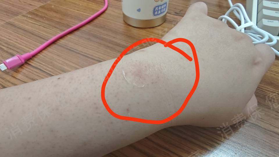 小米质量问题