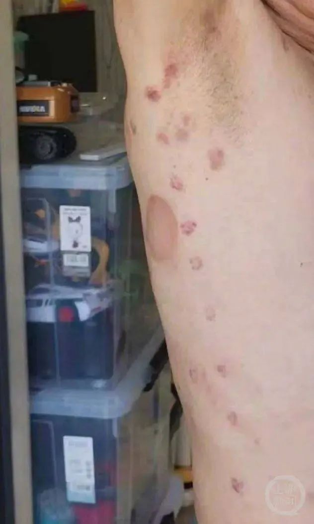 “服务的跪着说家里穷”！男子称理发店充430万做灌肠后遭退费难，合肥警方深夜通报！