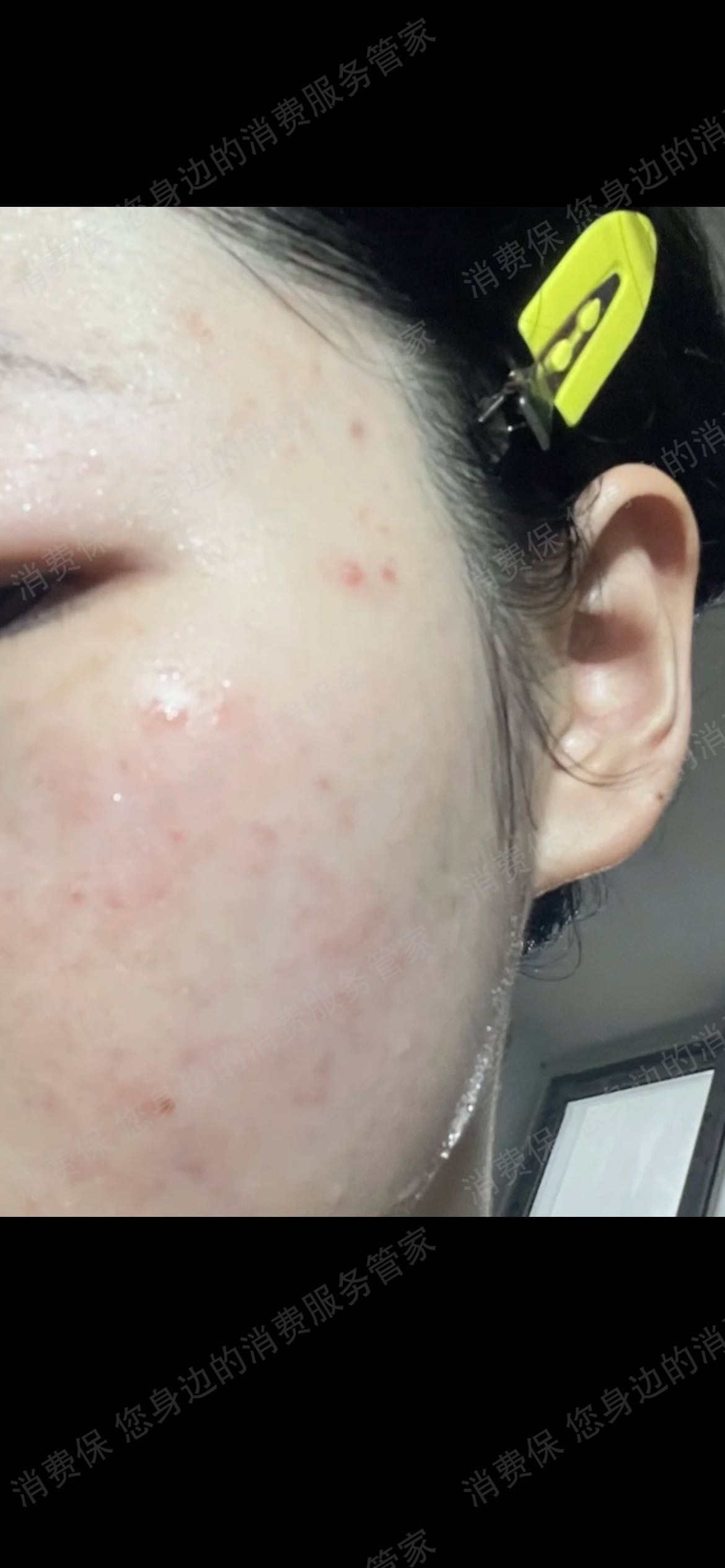 抖音商城（抖音购物纠纷）态度差/不处理