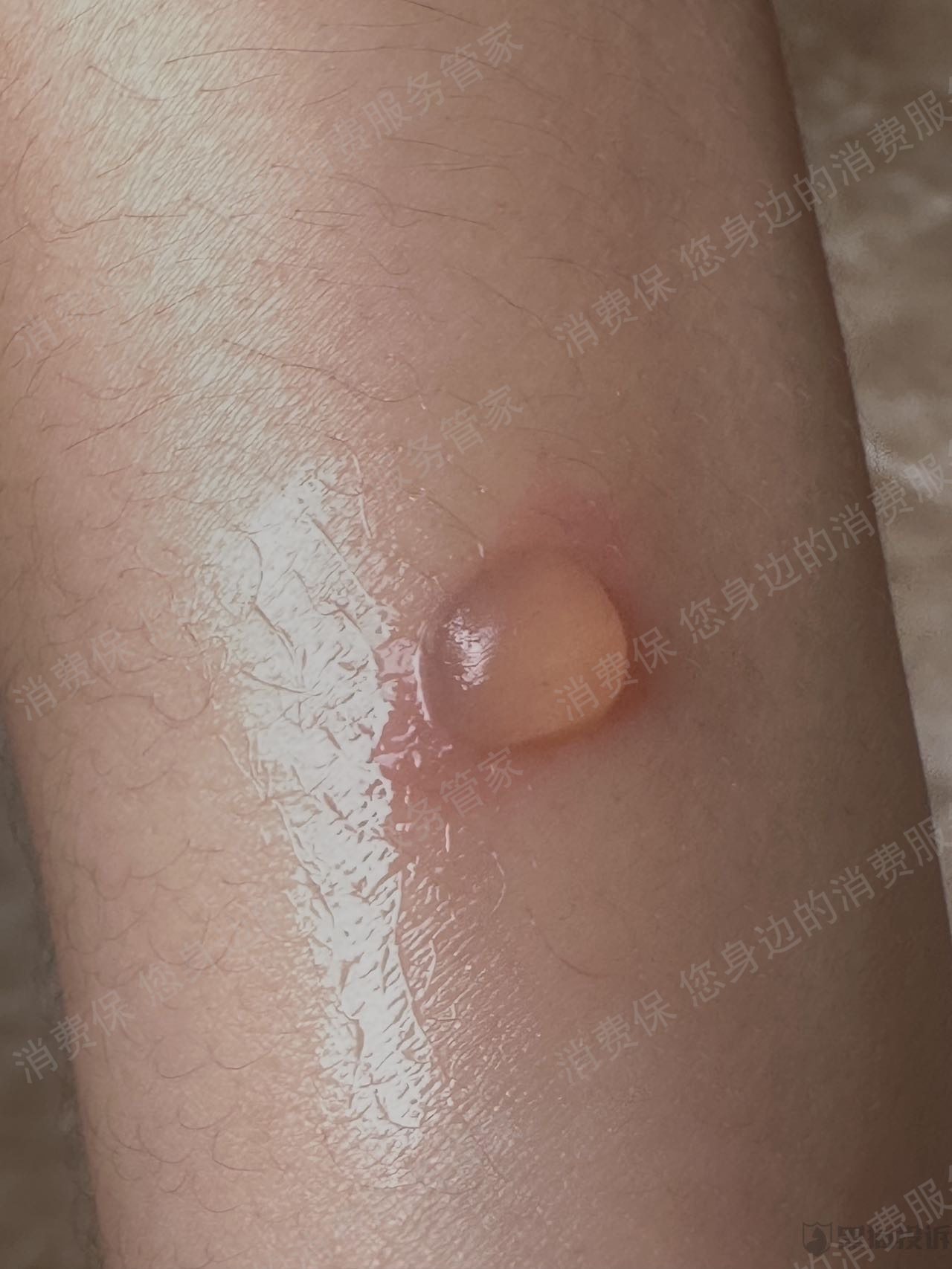 京东商城联系不上客服