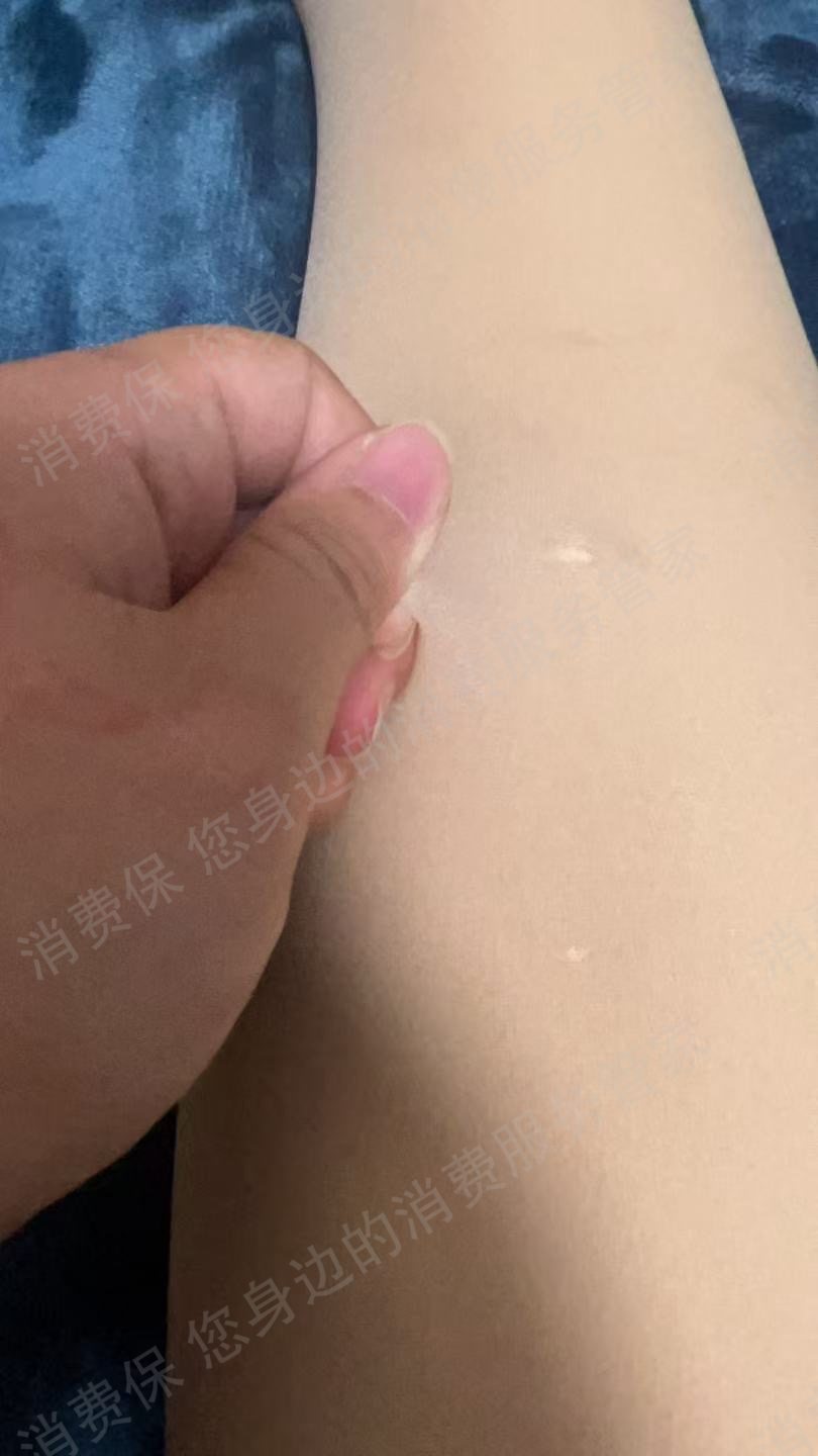 抖音商城（抖音购物纠纷）商品破损