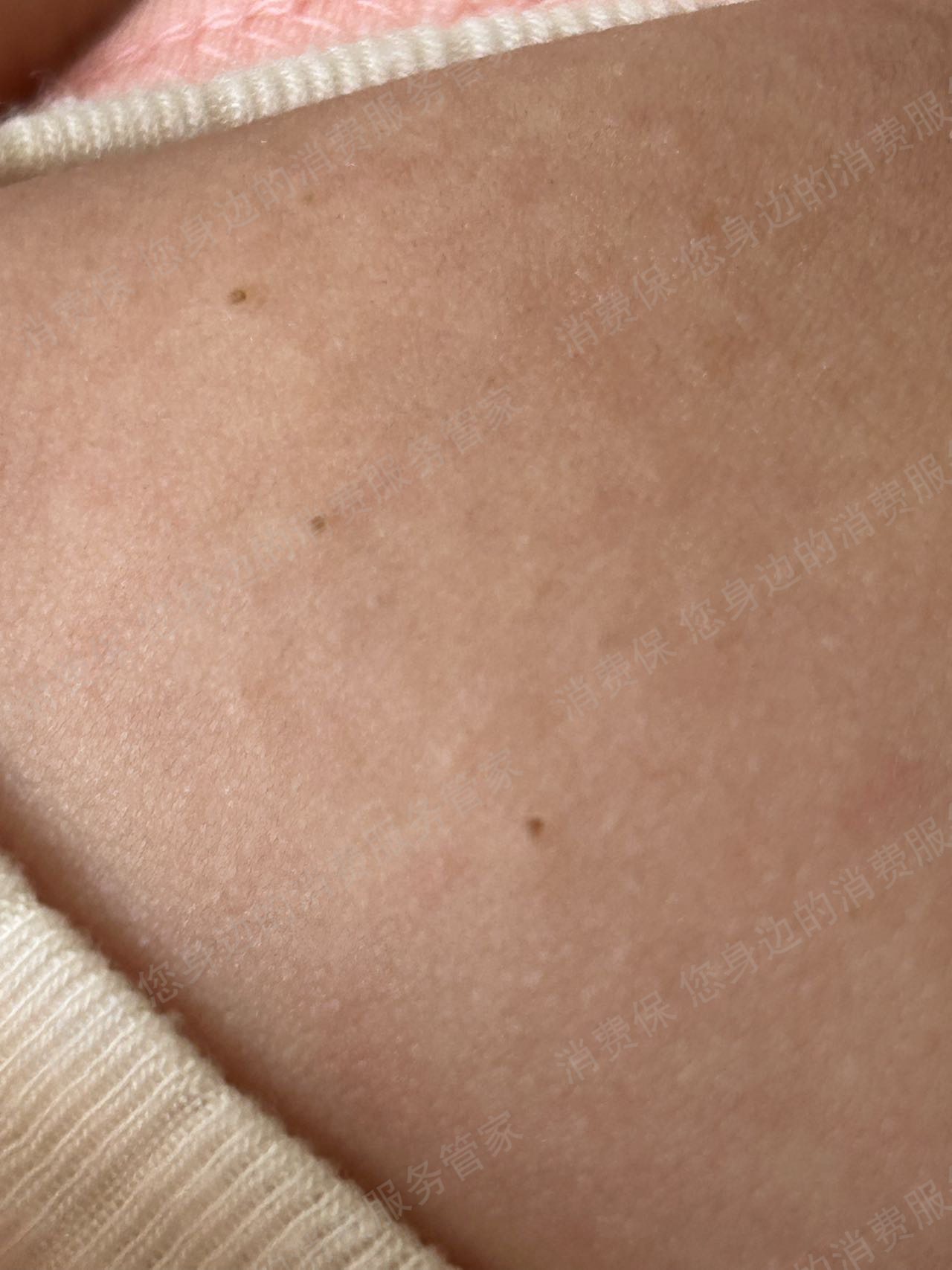 抖音商城（抖音购物纠纷）商品破损